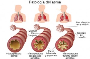 ASMA11